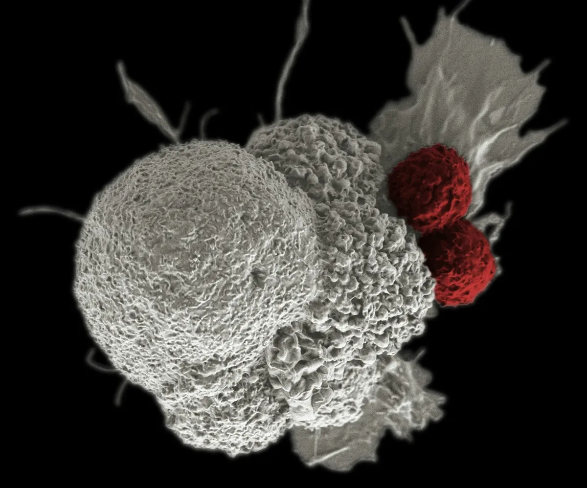 Revolutionary gene therapy reprogrammes immune cells inside the body to target tumours